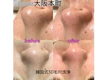 パイシーズ(Pisces)の雰囲気（毛穴洗浄で毛穴の黒ずみ詰まりが一度の施術でここまで綺麗に！）