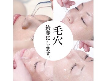 アンシャルム(Un charme)