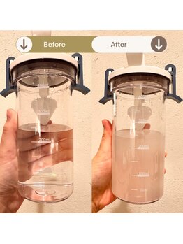 プラウド(Proud)/ケア症例/ハイドラで取れた汚れ