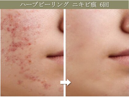 椿(TSUBAKI)の写真