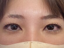 エイジレス(AGELESS)/ポイント→上下セット中顔面短縮