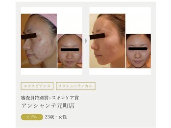 まりも化粧品店/ホワイトスノーピール