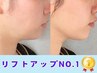 限定価格【小顔プラズマ5回コース】お顔がシュッとスッキリ明るく仕上がる♪