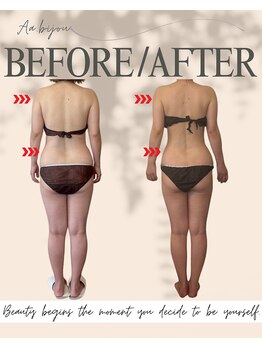 エイエービジュー(Aa.bijou)/