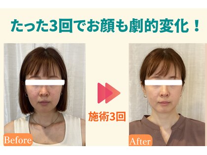 ウォーブ(Wobe)の写真