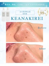 リアム(LiAm)/毛穴洗浄