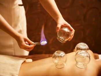 ふたたび 立川店/本格的な伝統療法:吸玉・かっさ