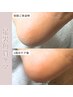 【foot】角質ケア・ネイルケア＋フットマッサージ付♪　￥5,500‐→¥5,200-