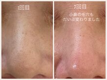 グランボヌール(grand bonheur)/【バクテリウムピール】