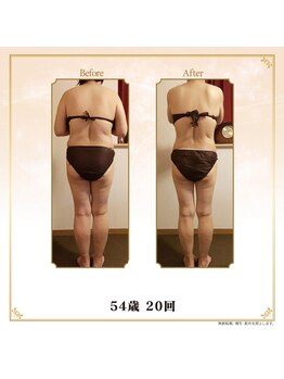 ベルシア 吉祥寺店(BELCIA)/