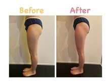 クレビア 麻布十番(CREBIA)/短期間で下半身スッキリ！！