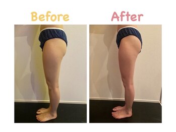 クレビア 麻布十番(CREBIA)/短期間で下半身スッキリ！！