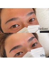 ダリ(Dali)/メンズハリウッドブロウリフト