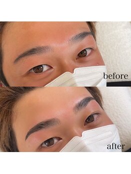 ダリ(Dali)/メンズハリウッドブロウリフト