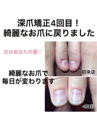 爪の形に困っている方も相談可能