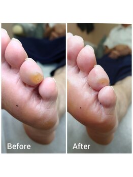 リゼラアンドコー 水戸店/ドイツ式フットケア専門店