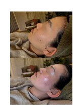 マシェリ(MA CHERIE)/フェイシャルWAX