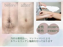 サンゴーハチ(358)の雰囲気（光脱毛もご用意してます！丁寧なカウンセリング、施術が人気★）