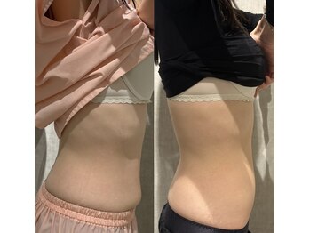 マホロバ セカンド(mahoroba 2nd)/腸もみbefore after