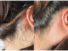 エステ リラクゼーションサロン(more)/うなじ・えりあしWAX脱毛