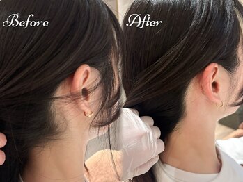 ピミル(PIMIL)/うなじ脱毛