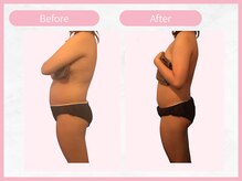 アールエイチビー 藤沢店(RHB)/