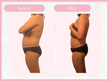 アールエイチビー 藤沢店(RHB)/