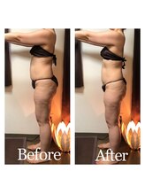 チャンティック(Cantik)/Before/After 