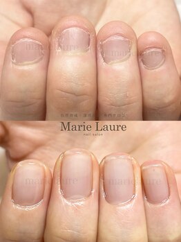 マリーロール 淀屋橋本店(Marie Laure)/自爪育成/深爪矯正/ネイルケア