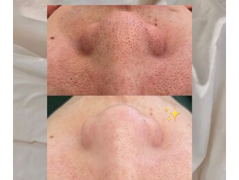 サロンド ユニバース(salon de universe)/長年の黒ずみもお任せ下さい!!