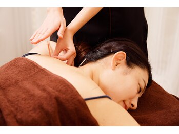 ラ コンシェル 代々木上原店/鍼灸施術