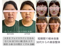 ケオラ(KEORA)の雰囲気（元に戻りにくい施術で短期改善&短期卒業を目指します！）