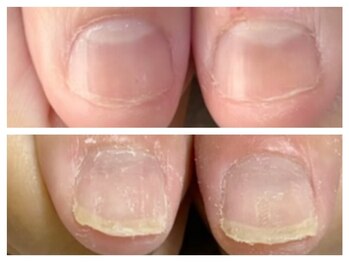 グレースレディ/白いところも伸ばせるように