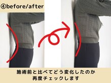 ストラボ 横浜店/目で見てわかる施術変化