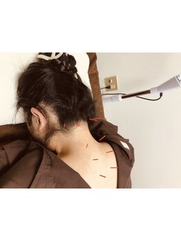 首・肩のつらさを改善したい