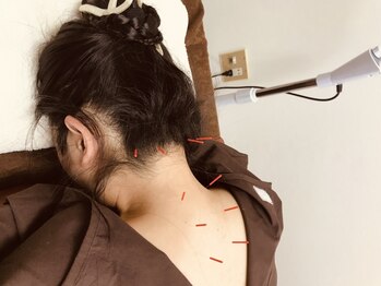 リバー鍼灸院(river鍼灸院)の写真/【鍼灸施術】血行不良が原因の首肩の辛さは鍼灸で血流改善♪眼精疲労、顔色の悪さにも◎