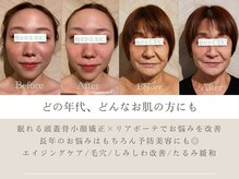 エクボ 立川店(EKUBO)