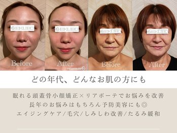 エクボ 立川店(EKUBO)