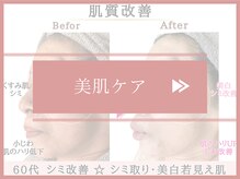 グレースエール トータルビューティーサロン(Grace Aile)/＊美肌ケア＊