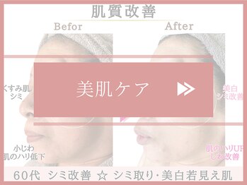 グレースエール トータルビューティーサロン(Grace Aile)/＊美肌ケア＊