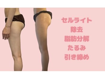 広尾痩身ビューティーサロン/【痩身/広尾/ダイエット】