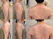 ボーテラボ 大宮(beaute LABO)の雰囲気（テポラ｜蓄積したお疲れに。後ろ姿すっきり、華奢見えボディへ）