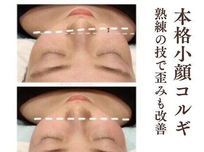 グラシーズ(Glasses)の写真