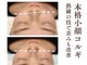 グラシーズ(Glasses)の写真