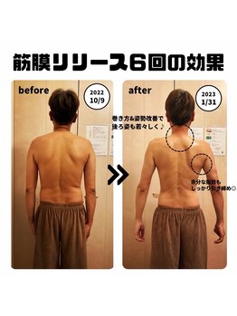 リリウム(Lilium)/筋膜リリース｜Before After