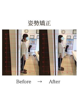心斎橋長堀フェムテック整骨院/36姿勢矯正　骨格矯正と骨盤矯正