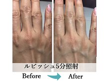 サロン ド オーヴ(salon de Orbe)/美肌美爪ハンドエステルビッシュ