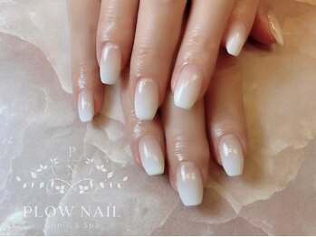 プラウネイル(Plow Nail)の写真/爪のお悩みは当店にご相談ください！丁寧なカウンセリングで、お客様に合わせた最適なご提案をいたします♪