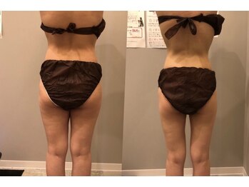 プシュケ(PSYCHE)/-8キロ達成★