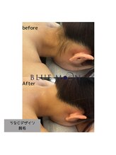 ブルームーン(BLUE MOON)/うなじ脱毛デザインシェービング